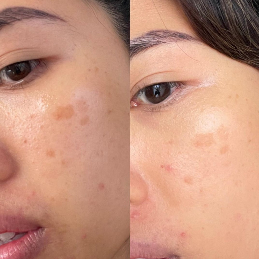 Vitamin C Booster Treatment, 15mL