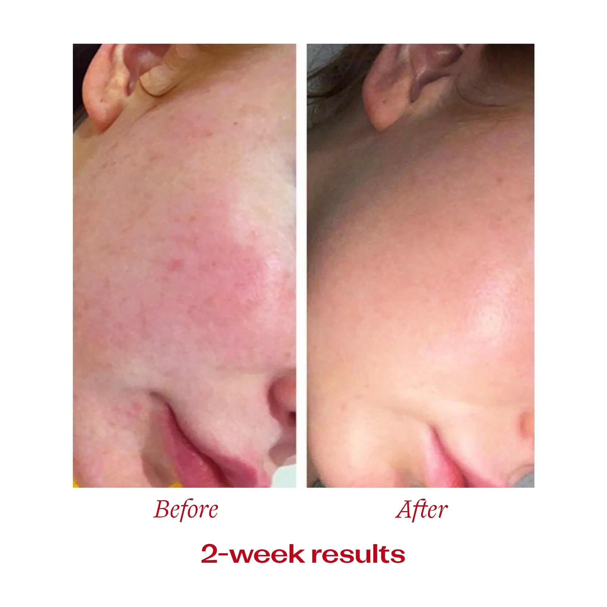 Vitamin C Booster Treatment, 15mL Trilogy