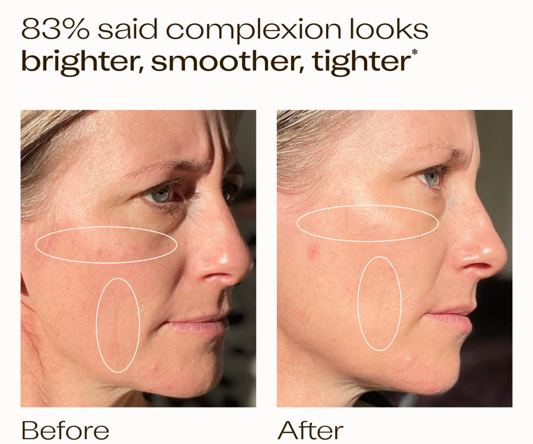 "Over the four weeks I have noticed an overall improvement in my skin condition, it is more hydrated, skin tone seems more even, redness has reduced. It feels lovely on the skin and absorbs well. I definitely feel that my skin looks younger." N. Graham *Average self-assessment result from 24 volunteers after four weeks of use. Used once or twice daily.