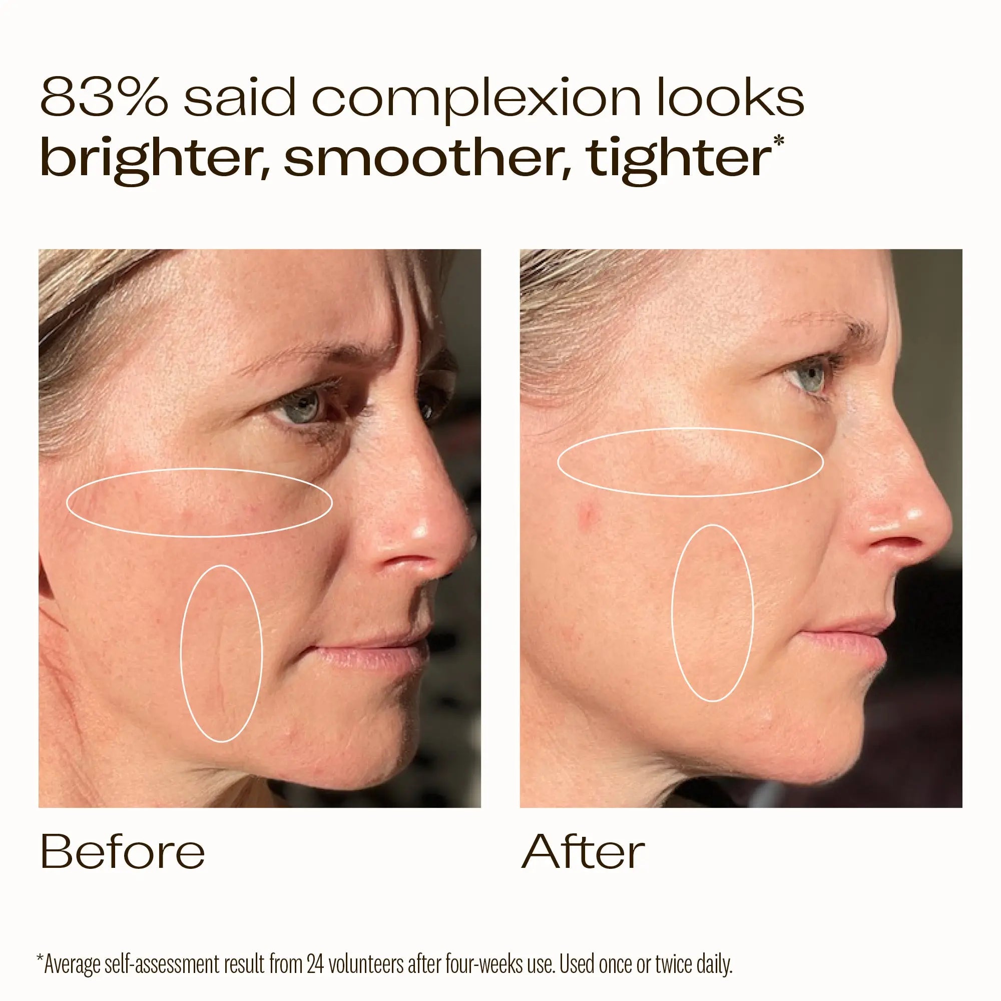 Vitamin C+ Super Serum, 30mL Trilogy