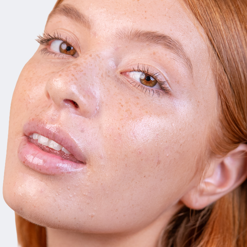 Sensitive skin