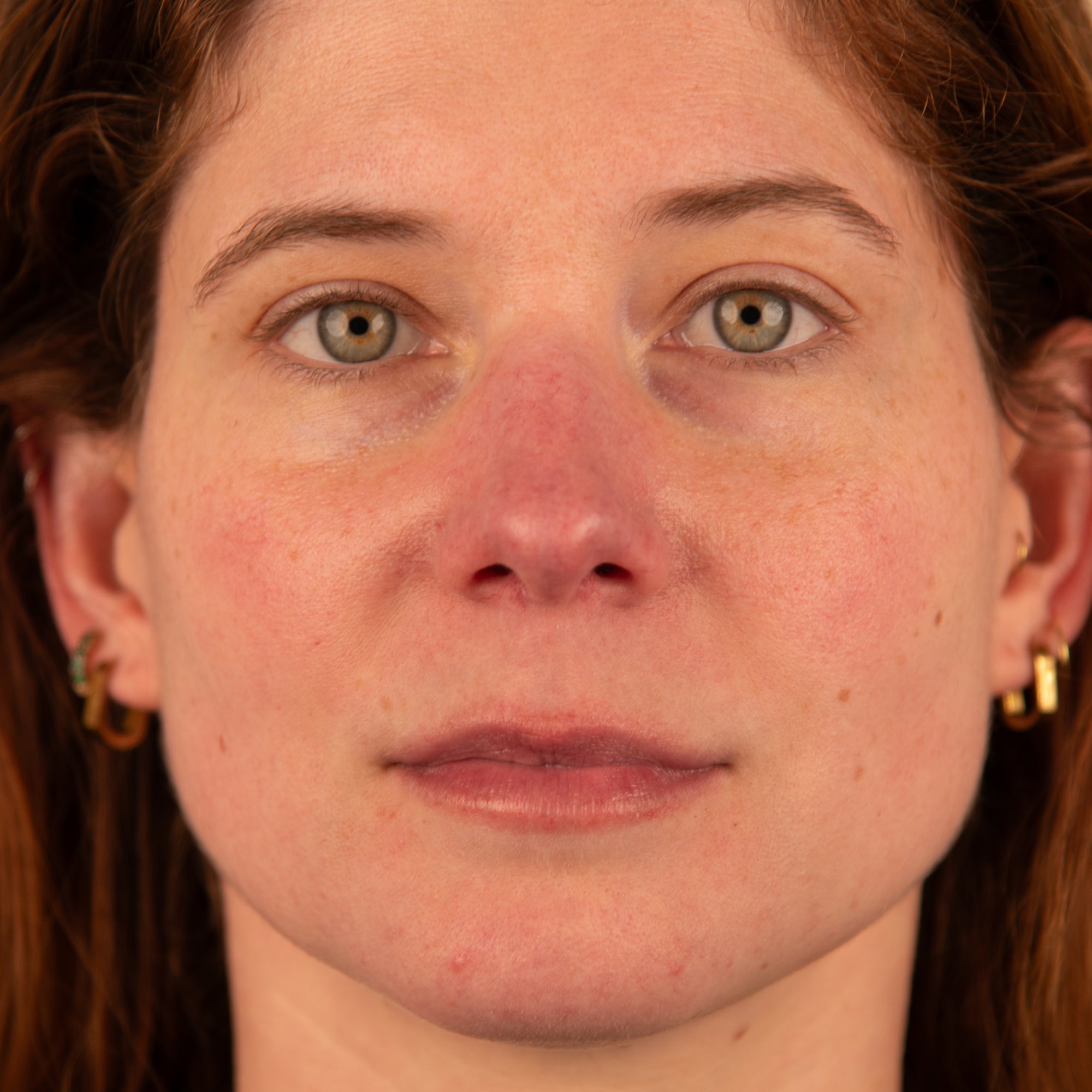Polyglutamic+ Booster serum before and after 2 weeks Trilogy NZ skin hydrating results