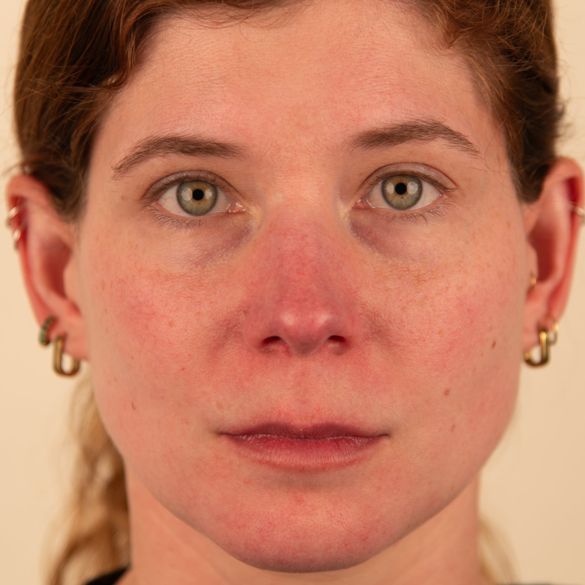Polyglutamic+ Booster serum before and after 2 weeks Trilogy NZ skin hydrating results